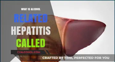 Understanding Alcohol-Related Hepatitis: Causes, Symptoms, and Treatment