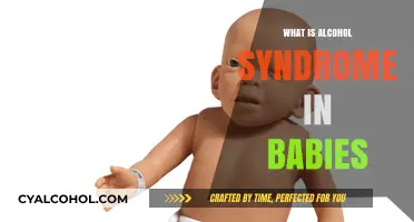 Understanding Fetal Alcohol Syndrome: Impact on Babies' Health
