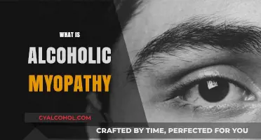 Understanding Alcoholic Myopathy: Causes, Symptoms, and Treatment Options