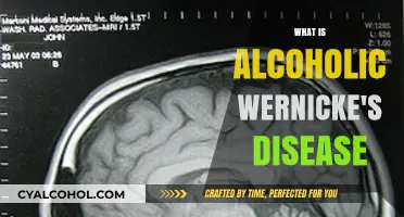Unveiling the Mysteries of Alcoholic Wernicke's Disease: A Comprehensive Guide