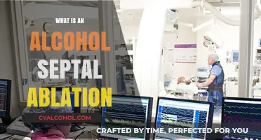 Understanding Alcohol Septal Ablation: A Minimally Invasive Heart Procedure