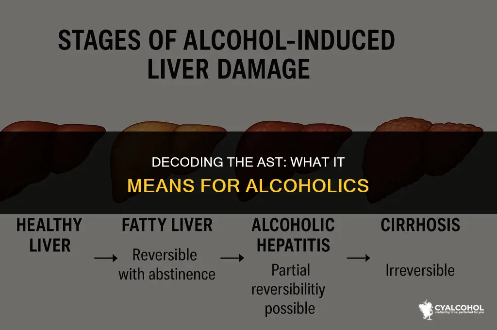 what is an alcoholics ast level