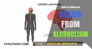 Understanding Cerebellar Ataxia: The Impact of Alcoholism on Coordination