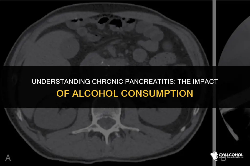 what is chronic pancreatitis and alcohol