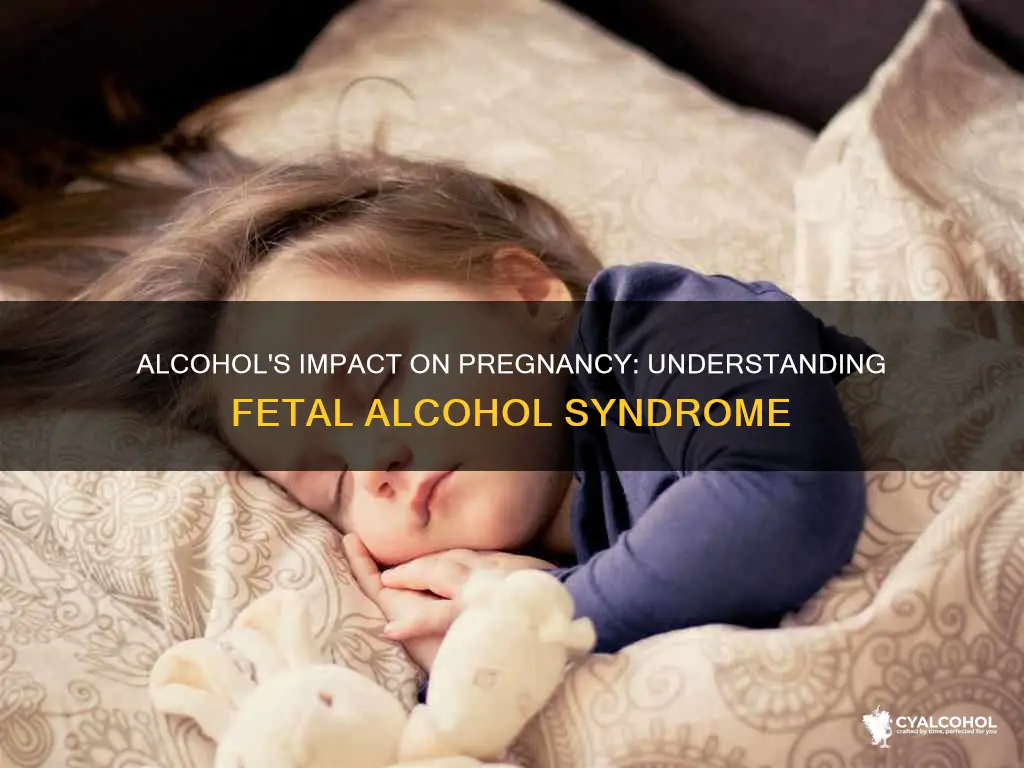 what is fetal alcohol syndrome and how does it occur