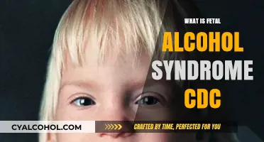 Understanding Fetal Alcohol Syndrome: A CDC Perspective