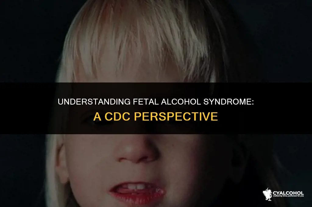 what is fetal alcohol syndrome cdc