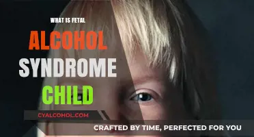 Understanding Fetal Alcohol Syndrome: A Guide for Parents and Caregivers