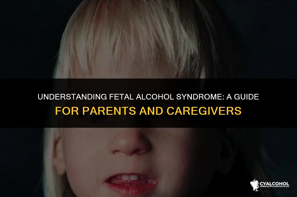 what is fetal alcohol syndrome child