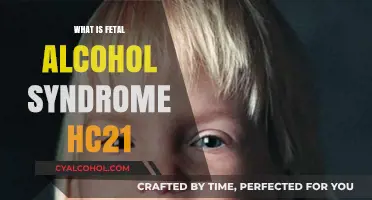 Understanding Fetal Alcohol Syndrome: Causes, Symptoms, and Prevention