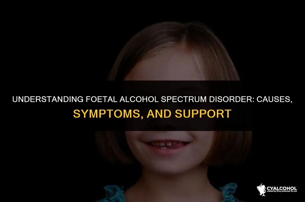 what is foetal alcohol spectrum disorder
