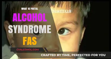 Understanding Foetal Alcohol Syndrome (FAS): Causes, Symptoms, and Prevention