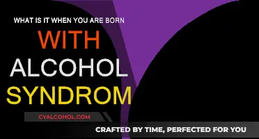 Alcohol Syndrome: The Birth Defect You Need to Know