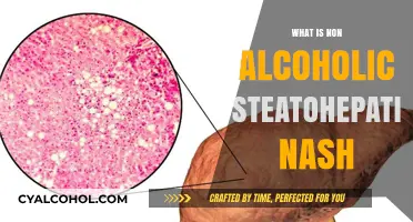 Understanding Non-Alcoholic Steatohepatitis (NASH): Causes, Symptoms, and Treatment