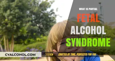 Understanding Partial Fetal Alcohol Syndrome: A Comprehensive Guide