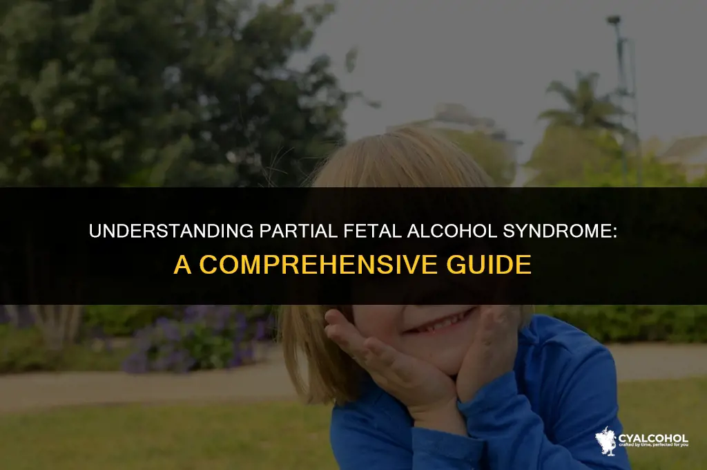 what is partial fetal alcohol syndrome
