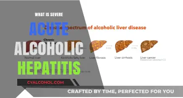 Understanding Severe Acute Alcoholic Hepatitis: Causes, Symptoms, and Treatment
