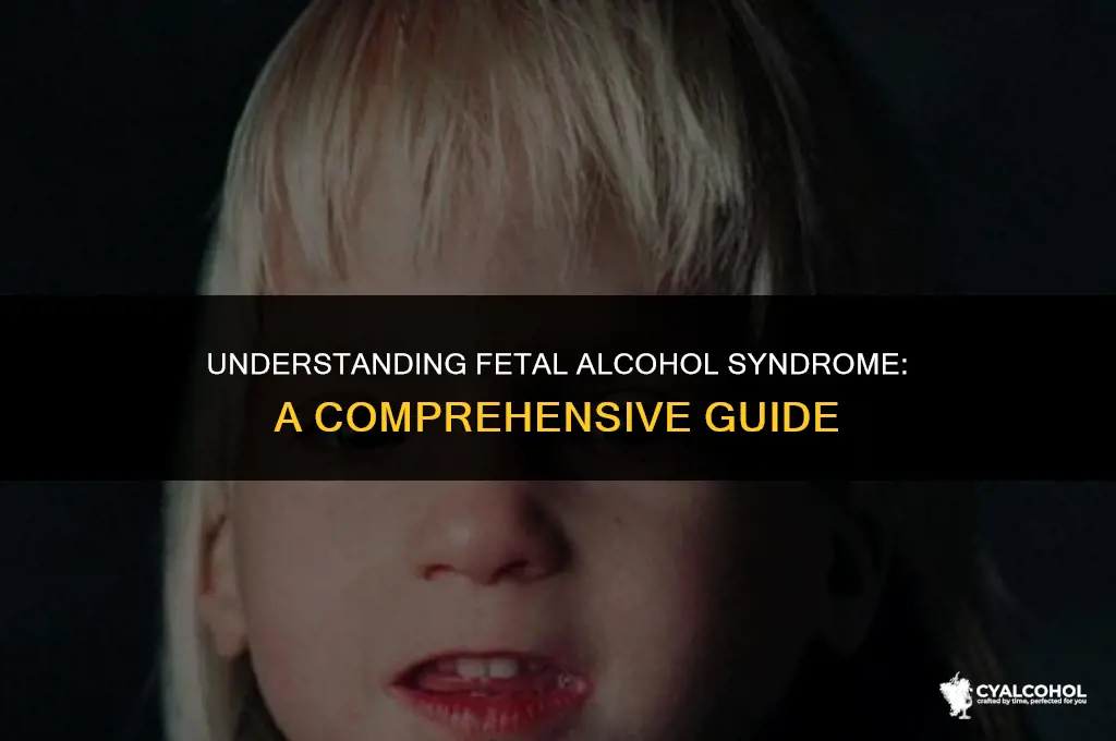 what is textbook fetal alcohol syndrome