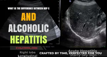 Hep C vs Alcoholic Hepatitis: What's the Difference?