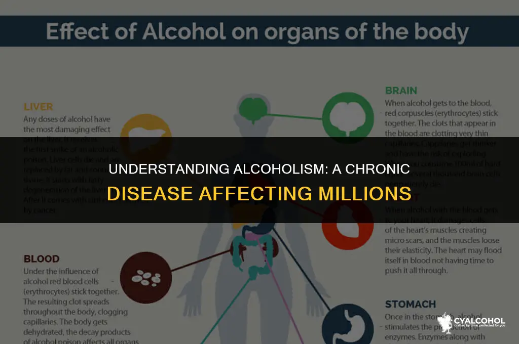 what is the disease of alcoholism