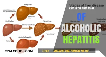 Understanding Alcoholic Hepatitis: The Initial Stage and Its Symptoms