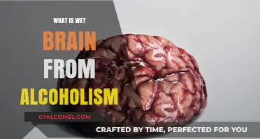 Understanding Wet Brain: The Devastating Impact of Alcoholism