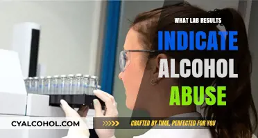 Decoding Lab Results: Key Indicators of Alcohol Abuse Revealed