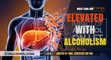 Elevated Liver Enzymes and Biomarkers Linked to Alcoholism: Key Labs Explained