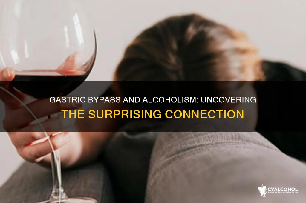 what percent of gastric bypass patients become alcoholics