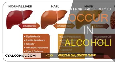 Alcoholism: A Gateway to Health Risks