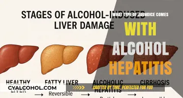 Alcoholic Hepatitis and Jaundice: Understanding the Link and Symptoms