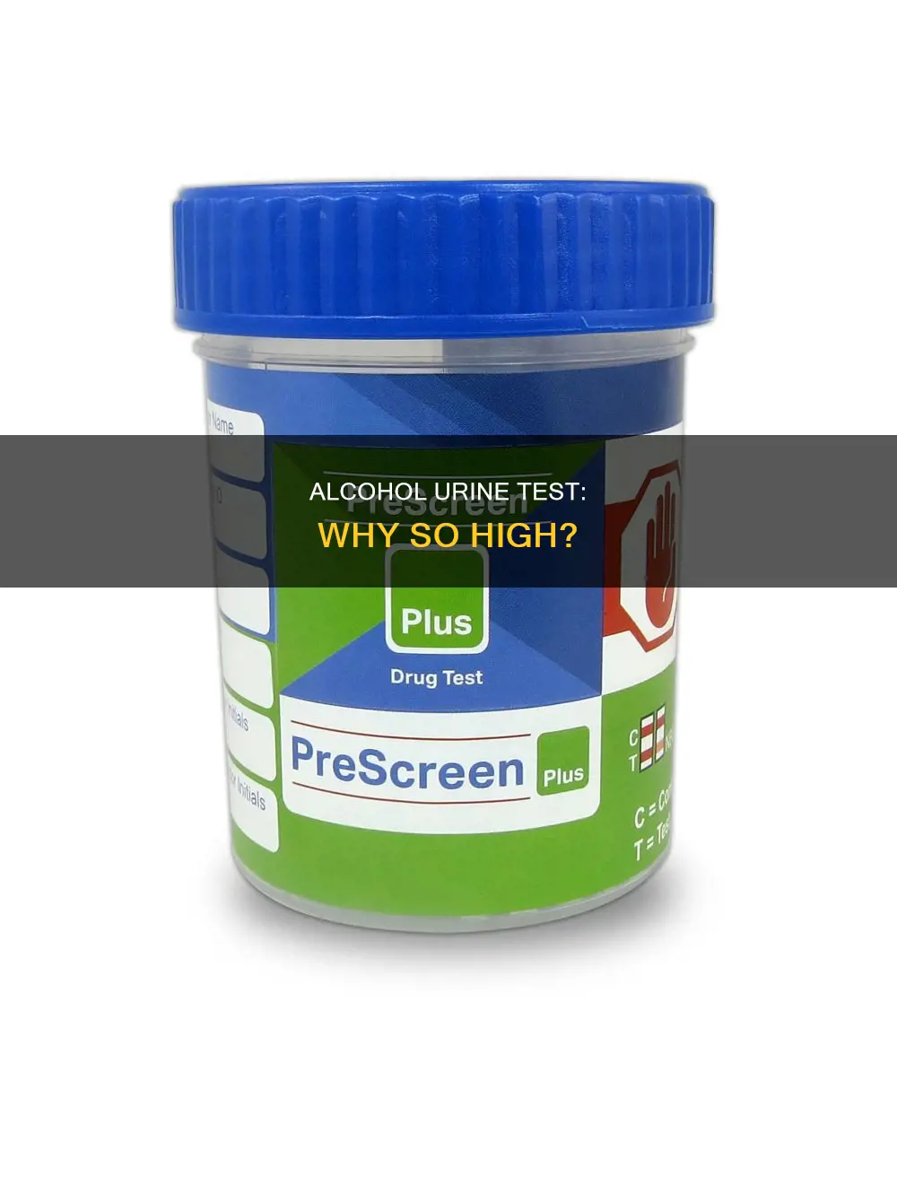 what would caise high levels of alcohol in urine