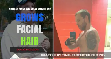 Alcoholics: Weight Loss and Facial Hair Growth