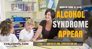 When Do Fetal Alcohol Syndrome Symptoms First Become Noticeable?