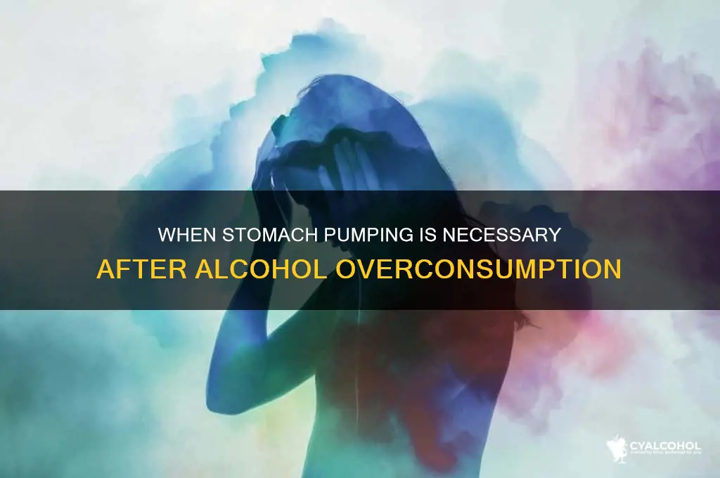 when do you need your stomach pumped alcohol