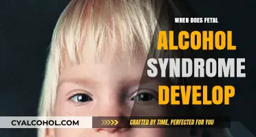 Understanding Fetal Alcohol Syndrome: Critical Development Stages and Risks