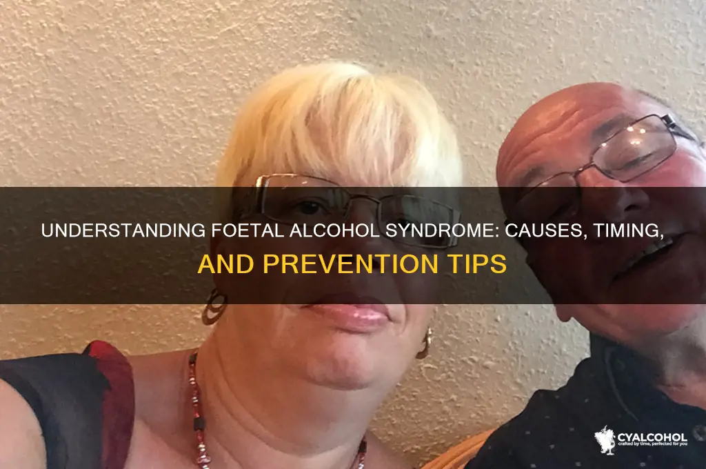 when does foetal alcohol syndrome occur