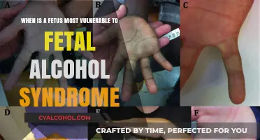 Alcohol and Pregnancy: Most Vulnerable Trimester