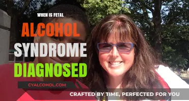 When Is Fetal Alcohol Syndrome Diagnosed: Key Timelines and Indicators