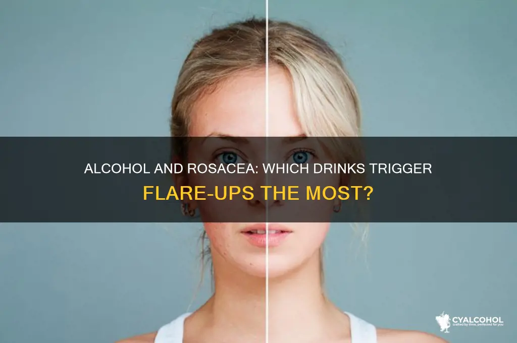which alcohol is worse for rosacea