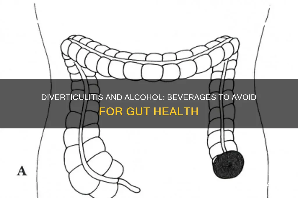 which alcohols to avoid with diverticulitis