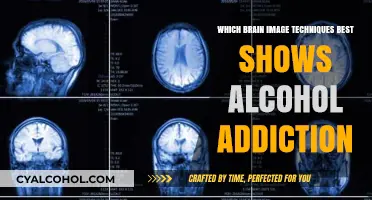Unveiling Alcohol Addiction: Optimal Brain Imaging Techniques for Accurate Diagnosis
