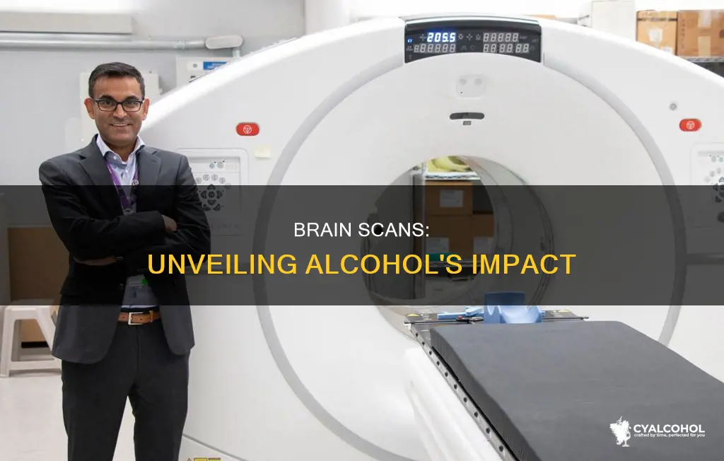 which brain image techniques produces an image about alcohol