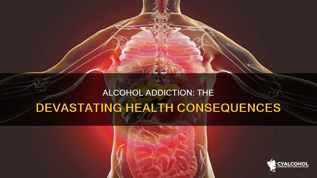 which condiiton is often a result of alcohol addiction