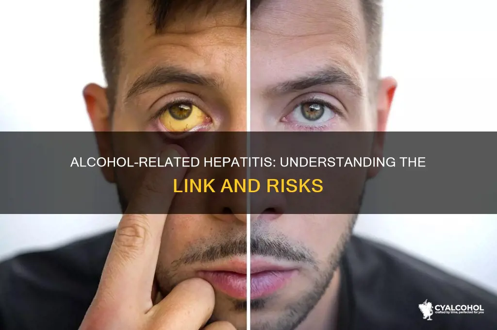 which hepatitis is related to alcohol