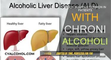 Alcoholism's Link to Brain Injuries