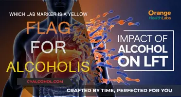 Yellow Alert: Lab Marker for Alcoholism
