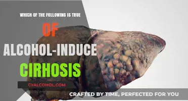 Alcoholic Cirrhosis: Understanding Its True Nature