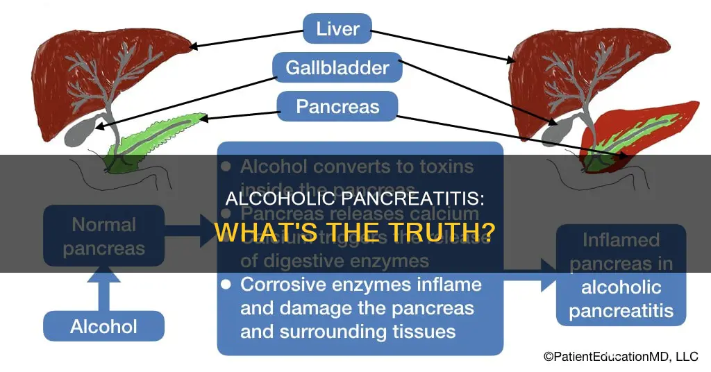 which of the following statements about alcohol-related pancreatitis is true