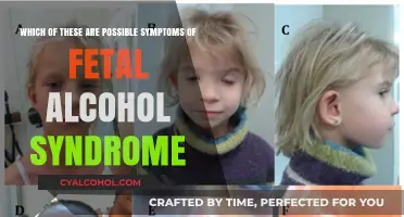 Alcohol's Impact: Potential Fetal Alcohol Syndrome Symptoms